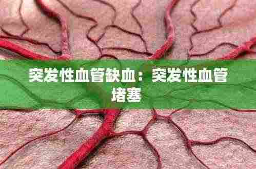 突发性血管缺血:突发性血管堵塞