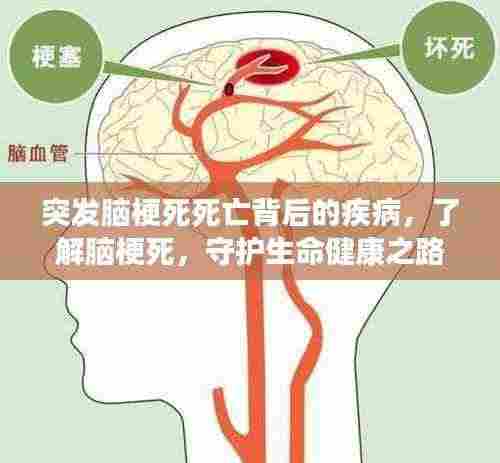 突发脑梗死死亡背后的疾病,了解脑梗死,守护生命健康之路