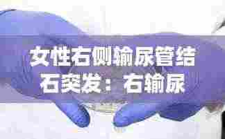 女性右侧输尿管结石突发：右输尿管结石是怎么引起的 