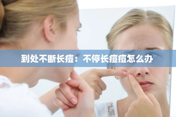 到处不断长痘：不停长痘痘怎么办 