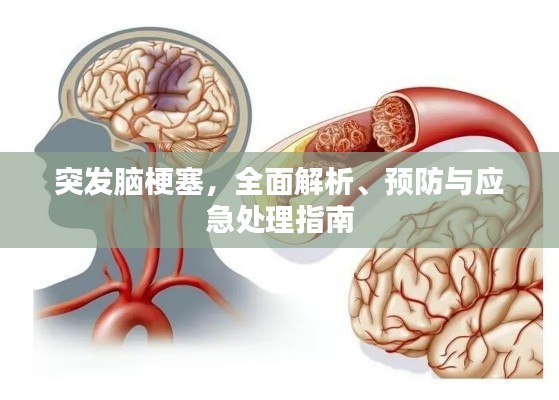 突发脑梗塞,全面解析、预防与应急处理指南