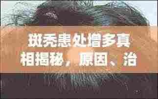 斑秃患处增多真相揭秘,原因、治疗与预防全攻略
